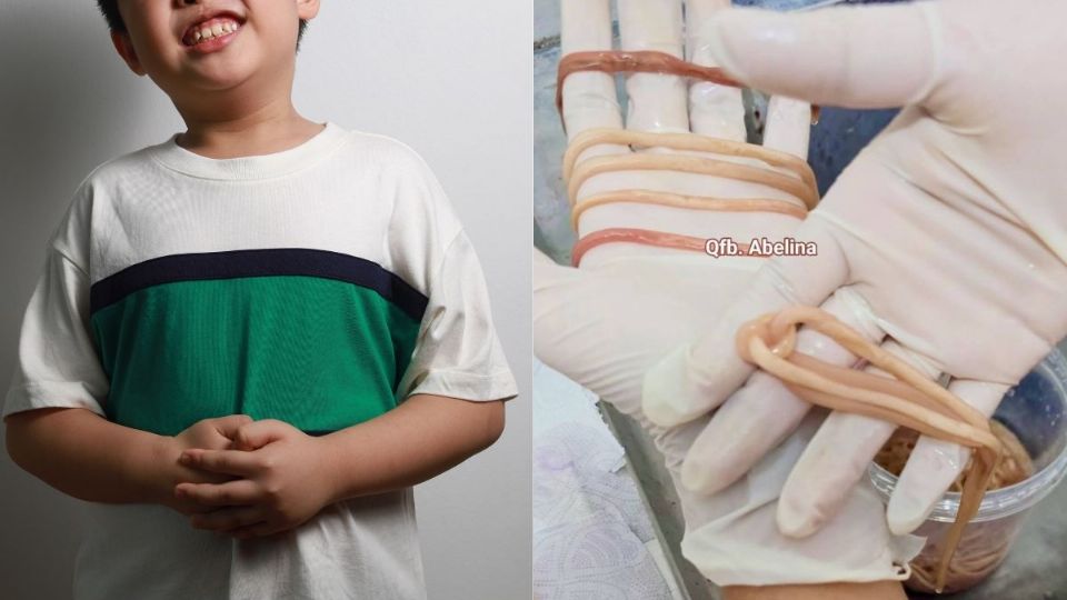 Los parásitos en el intestino de un menor de edad pueden ser peligrosos.