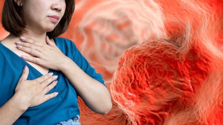 Varices esofágicas: Una grave complicación del hígado graso
