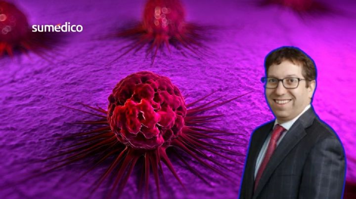 Cáncer antes de los 50: Oncólogo revela los síntomas que NO debes ignorar