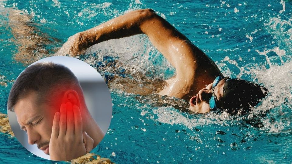 Hay formas de prevenir el dolor de oído tras nadar ya sea en la alberca o el mar.