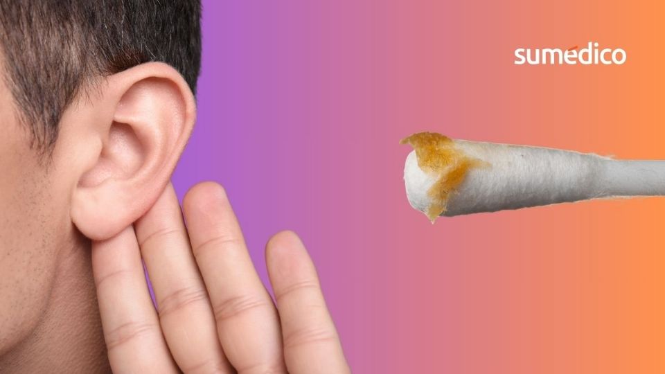 La cera es una secreción natural del cuerpo para proteger el canal auditivo