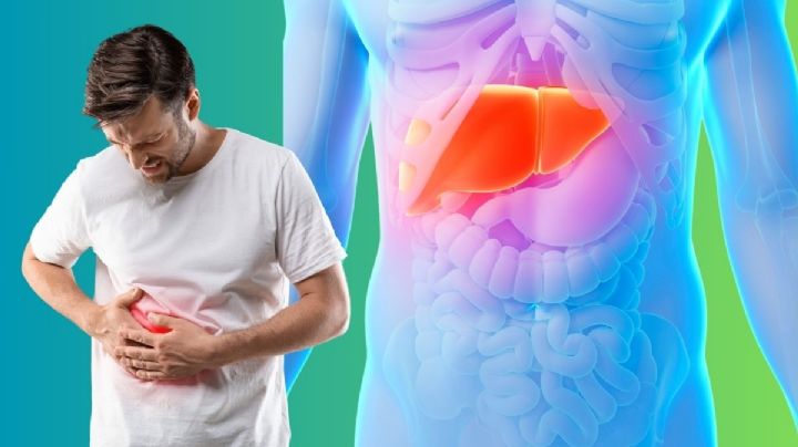 ¿Hígado graso? Expertos revelan 5 claves para revertirlo