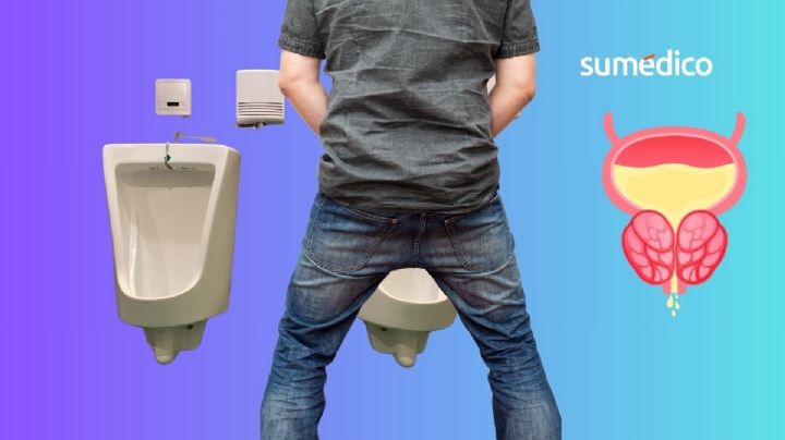 ¿Tienes próstata agrandada? Este tratamiento no invasivo lo alivia
