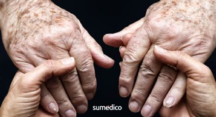 Cambios en las manos de adultos mayores y cuándo preocuparse