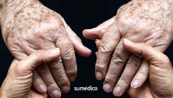 Cambios en las manos de adultos mayores y cuándo preocuparse
