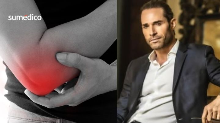 ¿Qué causa el codo de tenista, lesión que llevó al hospital a Sebastian Rulli?