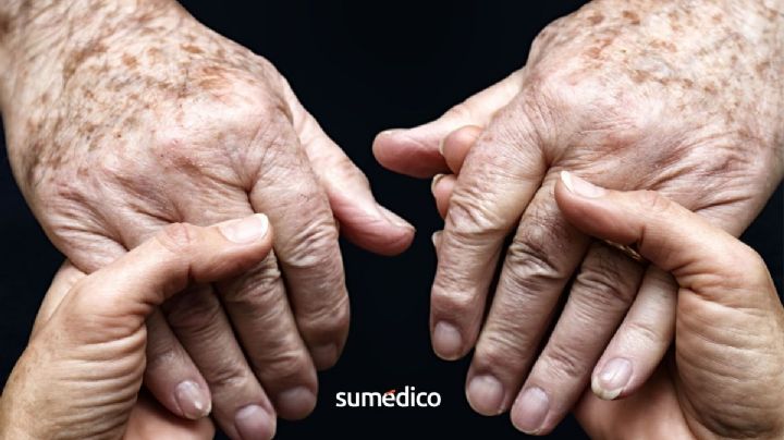 Cambios en las manos de adultos mayores y cuándo preocuparse