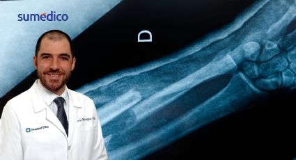 Oncólogo explica cómo detectar el sarcoma, un cáncer que afecta a jóvenes