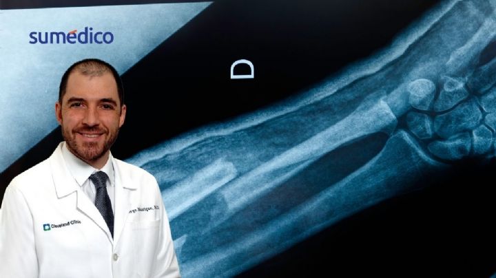 Oncólogo explica cómo detectar el sarcoma, un cáncer que afecta a jóvenes