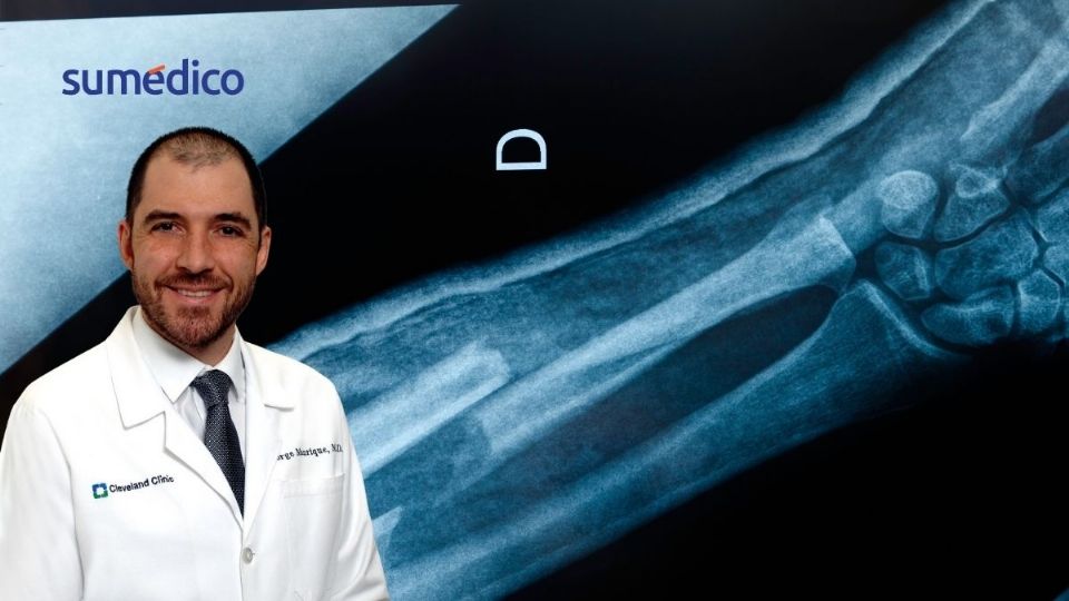 El Dr. Jorge Manrique-Succar nos explica los retos para prevenir el sarcoma
