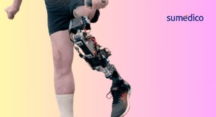 Científicos desarrollan prótesis de rodilla que garantiza el movimiento natural