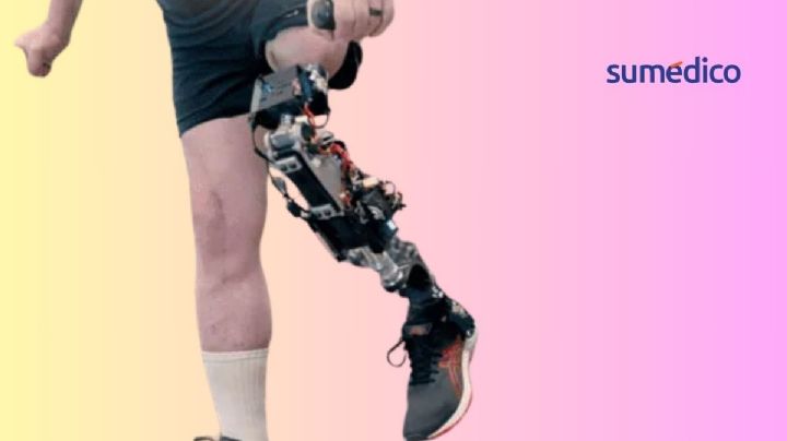 Científicos desarrollan prótesis de rodilla que garantiza el movimiento natural