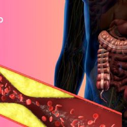 ¿Cómo influyen las bacterias intestinales en la obstrucción de las arterias?
