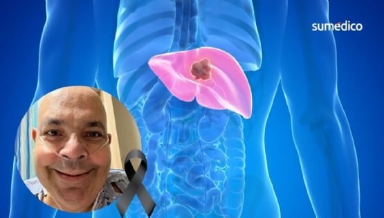 ¿Qué causa el cáncer de hígado y pulmón que sufrió el comediante Carlos Merced?
