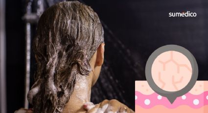 ¿Haces esto al bañarte? Es el peor error, según dermatólogos