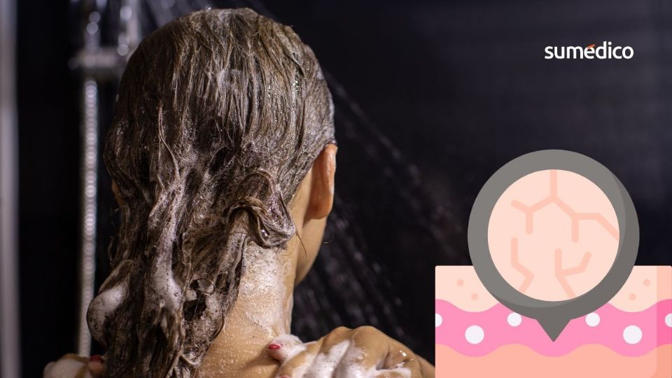 Cuidado con estos errores en la ducha que dañan la piel.