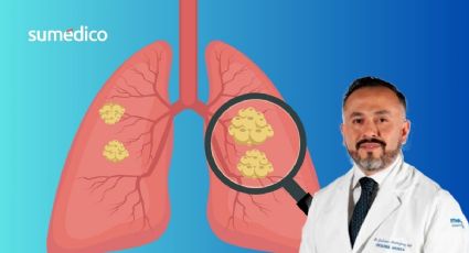 Oncólogo alerta los hábitos que NO sabías que causan cáncer de pulmón