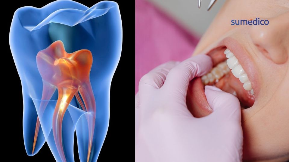 Científicos crearon dientes en un laboratorio que pueden evitar el uso de implantes artificiales.