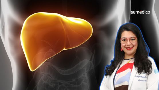 Nayelli Flores, hepatóloga: ‘Mexicanos tienen más riesgo de hígado graso por genética'