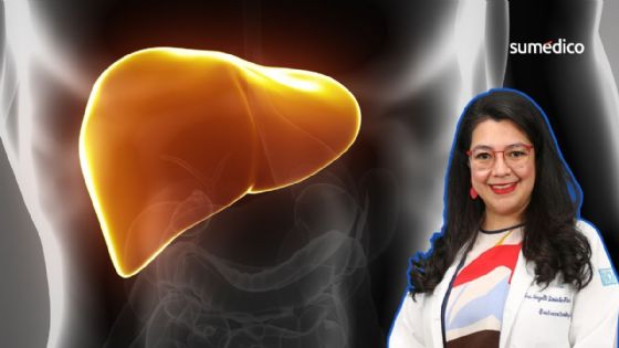 Nayelli Flores, hepatóloga: ‘Mexicanos tienen más riesgo de hígado graso por genética'