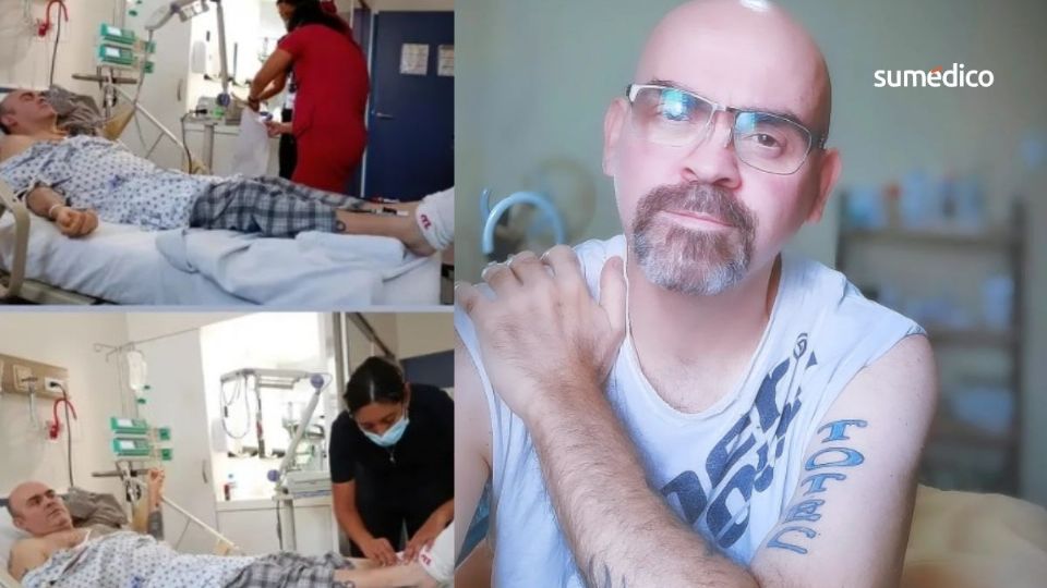 El actor de 48 años tiene una leucemia con una mutación que lo hace más agresivo.