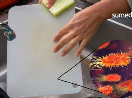 Cómo limpiar correctamente la tabla de cortar y eliminar todas las bacterias