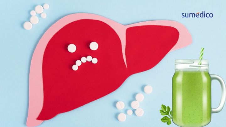 ¿Necesitas una desintoxicación hepática? Esto recomienda una hepatóloga