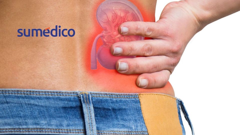 Conoce las señales que indican que algo NO anda bien en tus riñones