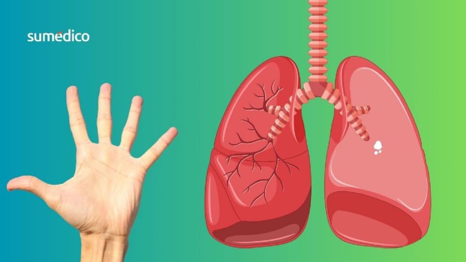Los dedos manifiestan los síntomas de los pulmonnes