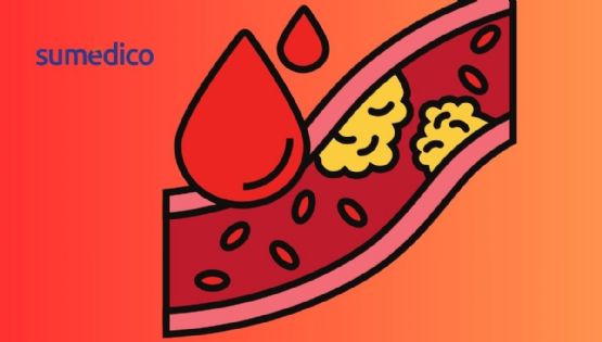 3 causas por las que tu colesterol está alto aunque no comas grasas, según cardiólogo