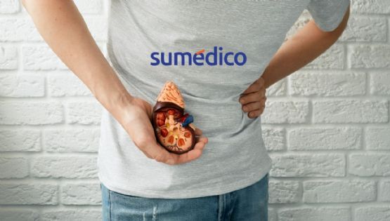 Qué síntomas avisan que tienes cálculos renales y cómo prevenirlos
