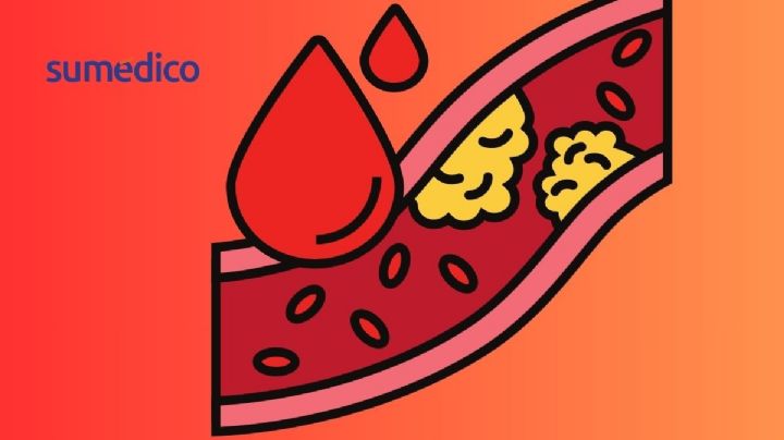 3 causas por las que tu colesterol está alto aunque no comas grasas, según cardiólogo