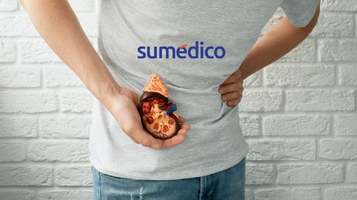 Qué síntomas avisan que tienes cálculos renales y cómo prevenirlos