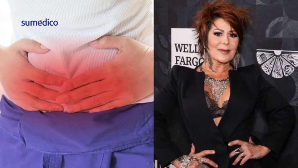 Una hernia puede requerir cirugía inmediata.