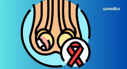 ¿Por qué aumentó el cáncer testicular en jóvenes durante los últimos años?