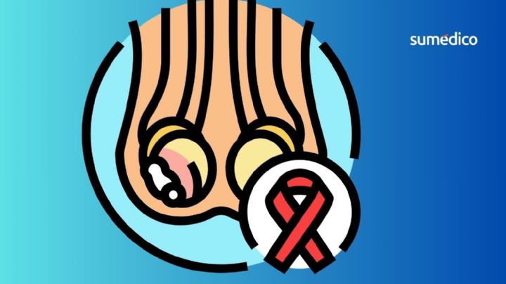 ¿Por qué aumentó el cáncer testicular en jóvenes durante los últimos años?