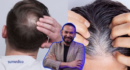 ¿Usar gorras causa calvicie?, ¿Es malo arrancarse las canas? Tricólogo responde
