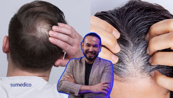 ¿Usar gorras causa calvicie?, ¿Es malo arrancarse las canas? Tricólogo responde
