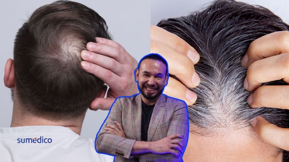 Las canas y la caída del cabello pueden revertirse o retrasarse con algunos cambios.