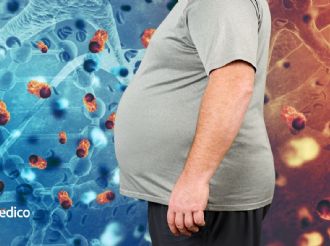Qué tipos de cáncer puedes prevenir al bajar de peso, según la ciencia