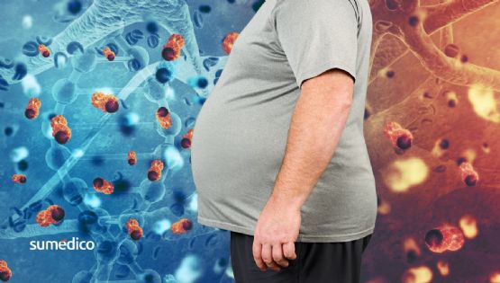 Qué tipos de cáncer puedes prevenir al bajar de peso, según la ciencia