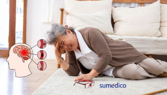 Señales que NO debes ignorar que avisan sobre un derrame cerebral