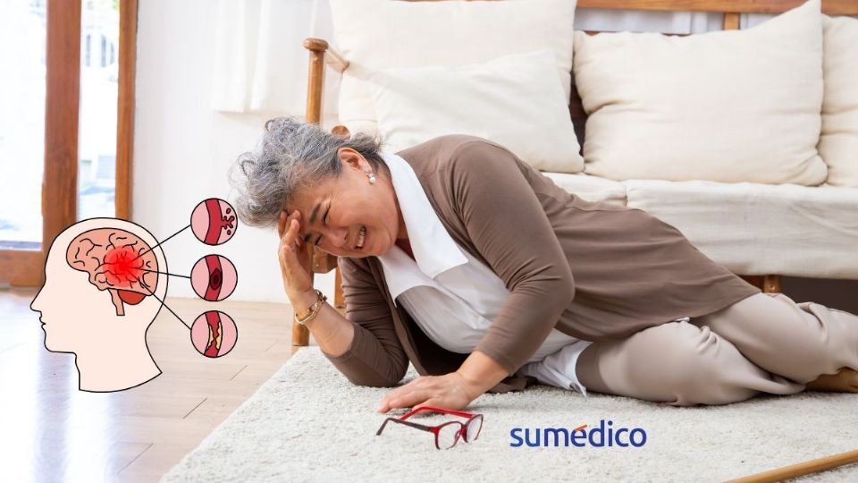 Conoce las señales que NO debes ignorar que avisan sobre un derrame cerebral