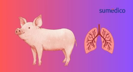 Realizan el primer trasplante de pulmón de cerdo a humano en China