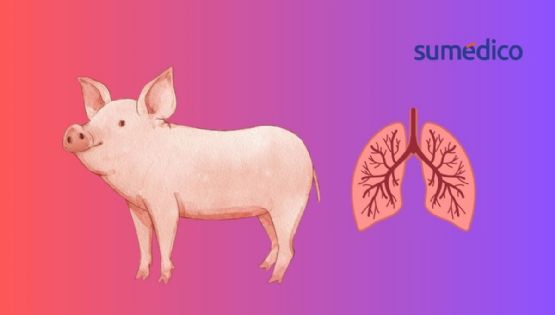 Realizan el primer trasplante de pulmón de cerdo a humano en China