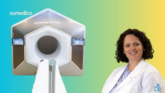 Nueva radioterapia con IA ataca tumores sin dañar tejido sano