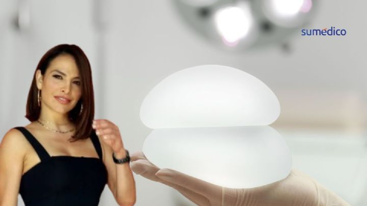 Fabiola Campomanes: ¿Por qué le tuvieron que remover los implantes mamarios?