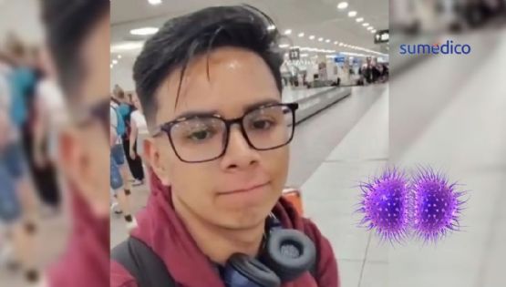 Joven mexicano viaja a Praga y pierde una pierna debido a una peligrosa bacteria