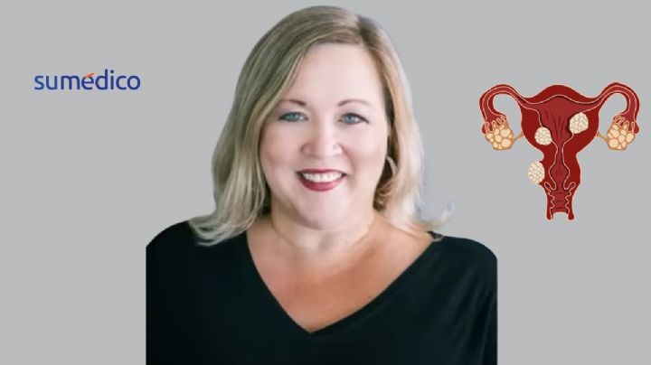 Me dijeron que mis síntomas eran comunes de menopausia luego descubrieron que tenía cáncer