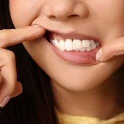 5 consejos para cuidar tus encías, según la Clínica Dental Barcelona